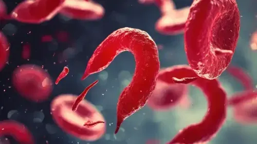 Difference Between Sickle Cell Anaemia and Sickle Cell Disease